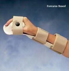 How Much Is Carpal Tunnel?